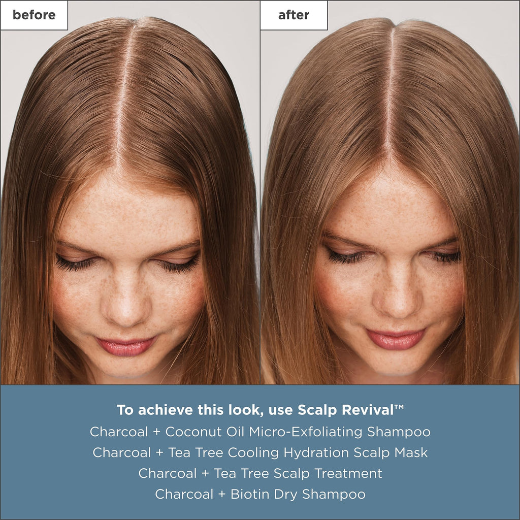 Briogeo Scalp Revival Charcoal + Tea Tree Scalp Treatment | Leave-In Serum